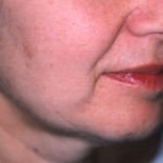 BLOG-5 WHY VOLUME MATTERS