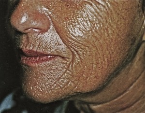 IMG0001 - Version 2 SUN PROTECTION