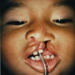 Nepal-3 Nepal A TRADITION OF HEALING: TRAVELING THE WORLD