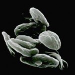 Picture1 Non-Surgical and Surgical Procedures