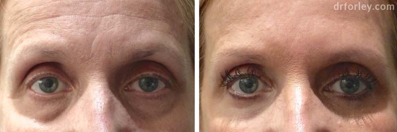 LEARN MORE ABOUT DR. FORLEY'S WORK: Eyes