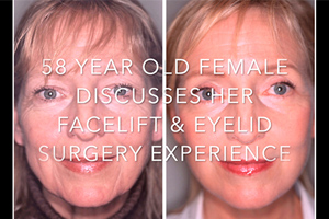 Watch Video: 58 year old female Discusses Her Facelift and Eyelid Surgery experience