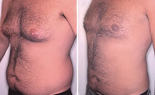 LEARN MORE ABOUT DR. FORLEY'S WORK: BREAST