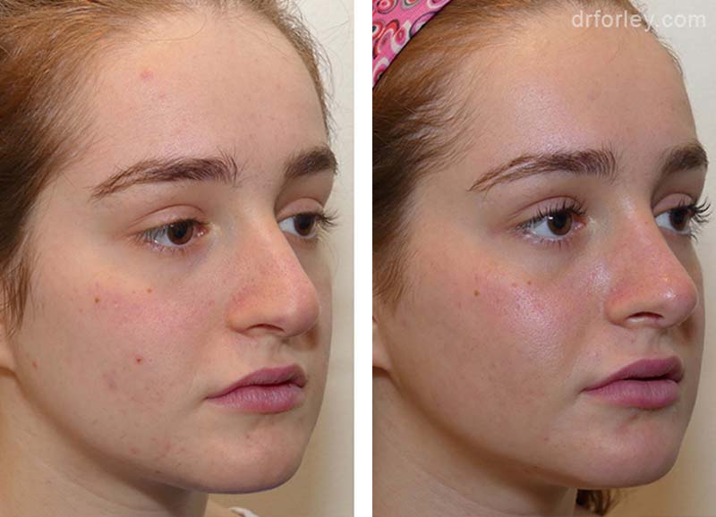 LEARN MORE ABOUT DR. FORLEY'S WORK: Nose