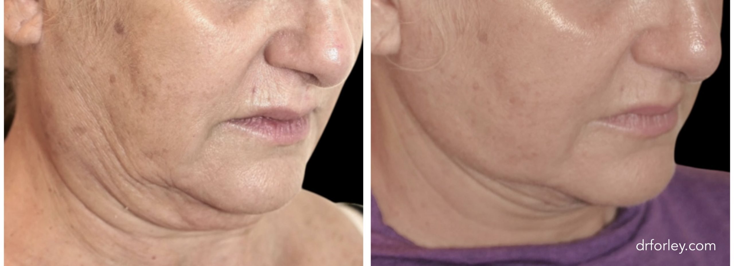 created by photogrid